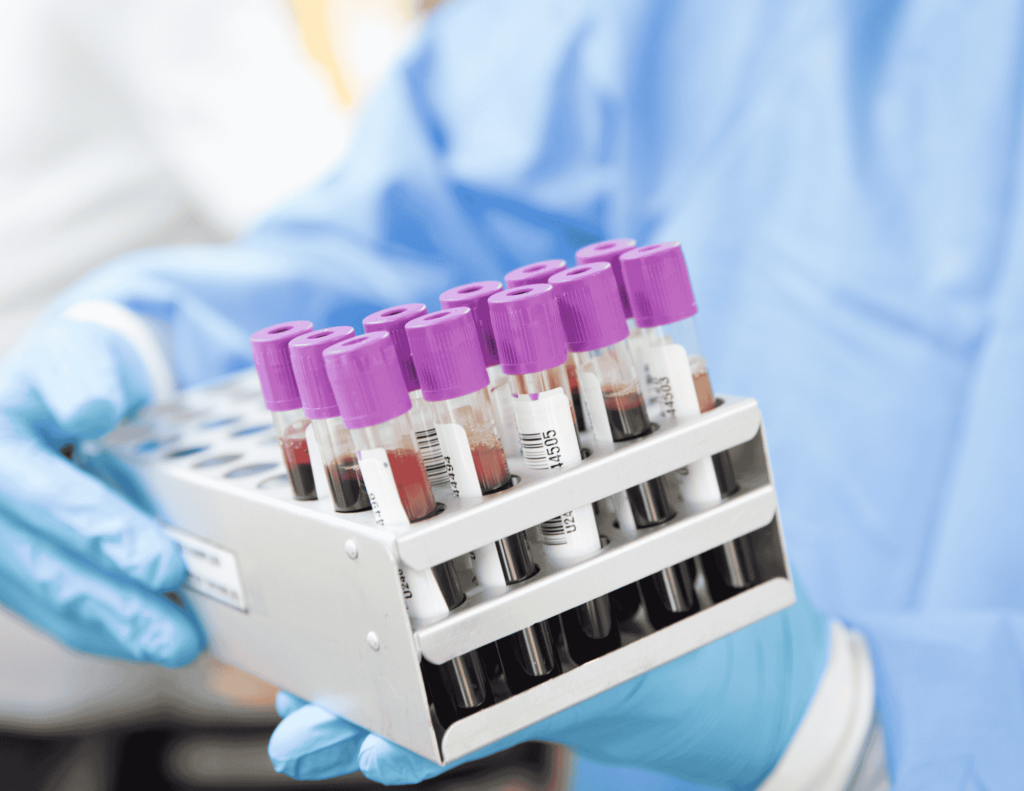 Hospital Based Lab